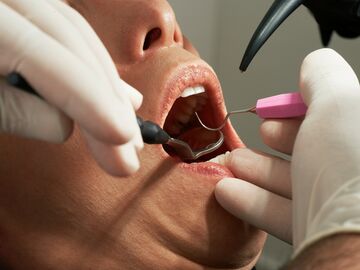 Dentist Supports